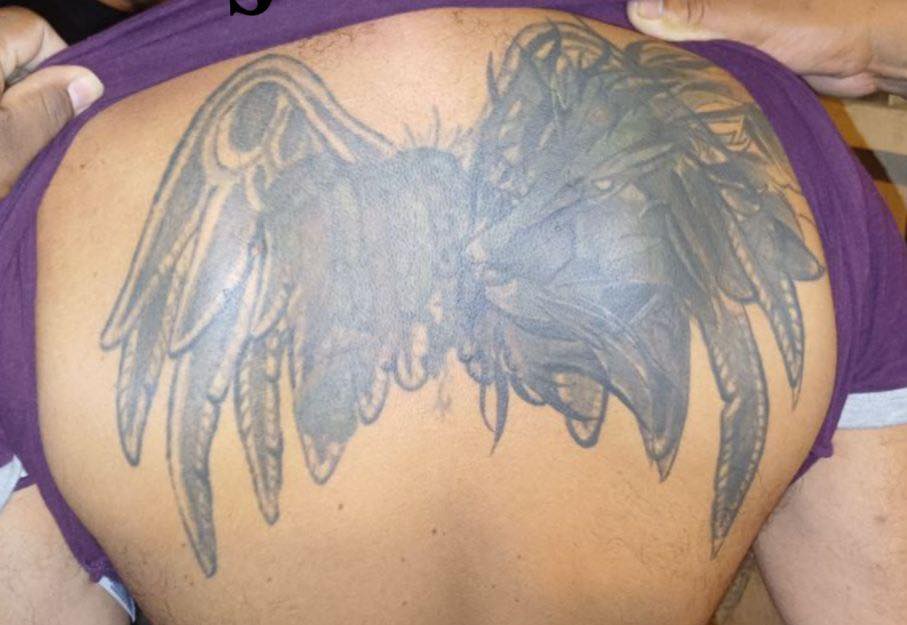 Deportan de Belice a pandillero que borró sus tatuajes y pretendía escapar de la justicia salvadoreña