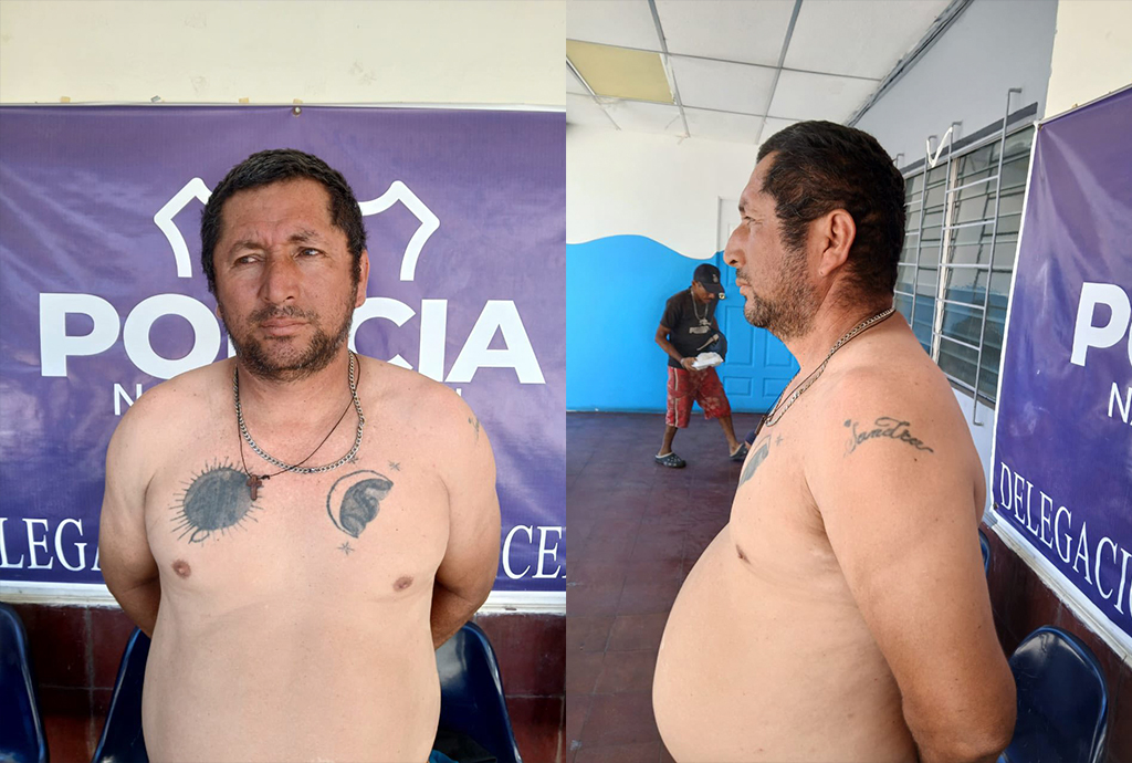 Policía captura a pandillero que intentó borrar sus tatuajes alusivos a su estructura criminal